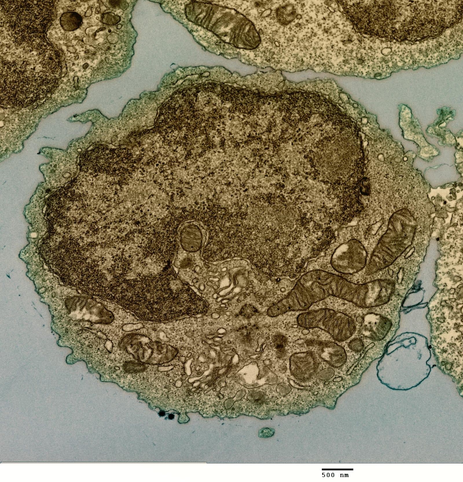 A B cell from a human donor, transmission electron micrograph