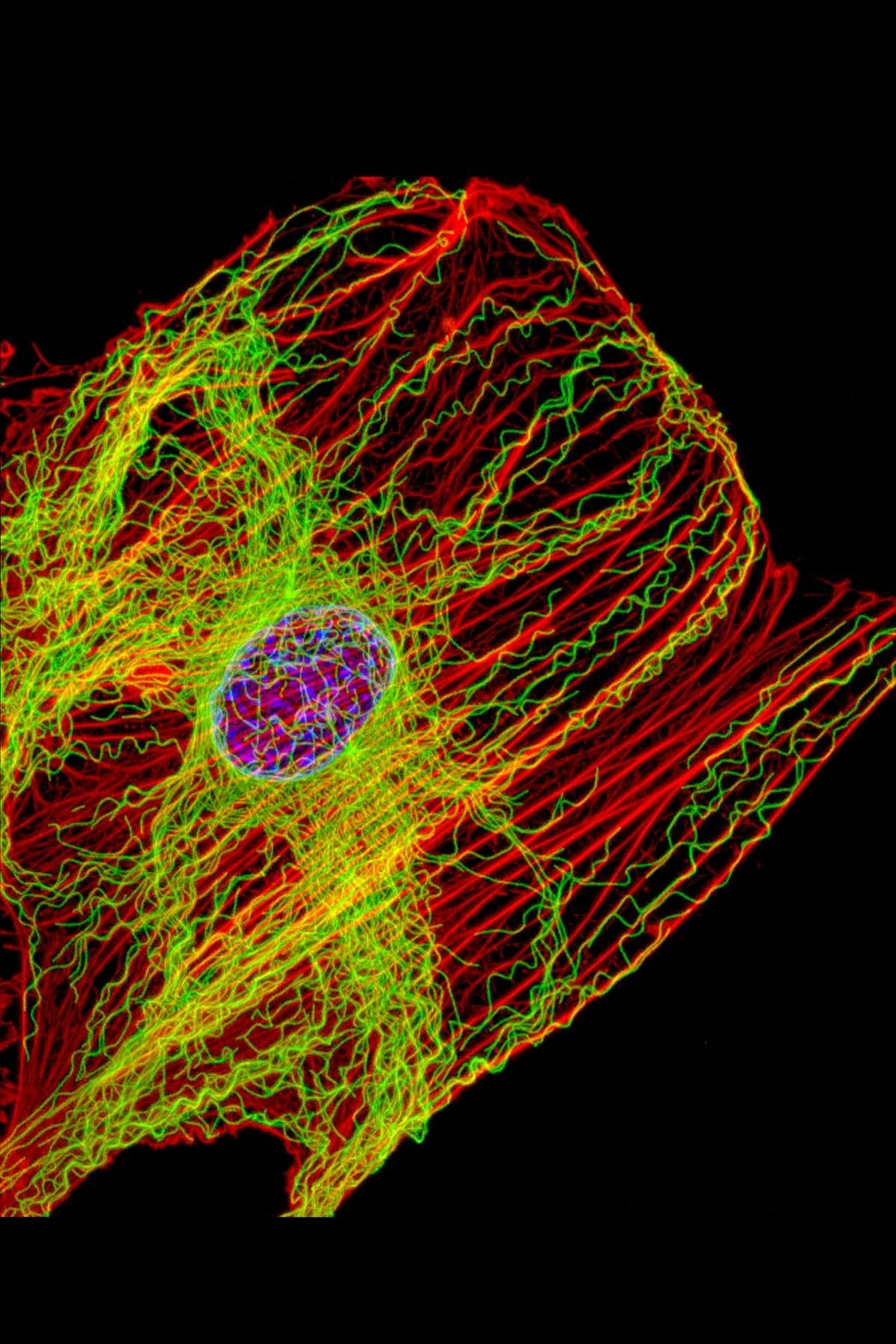 A fibroblast, fluorescence: actin in red, microtubules in green