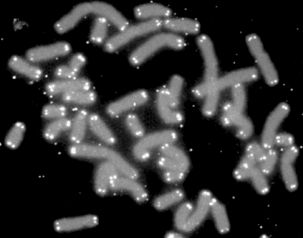 Cromosomas humanos (gris) con los telómeros iluminados en sus extremos (blanco)